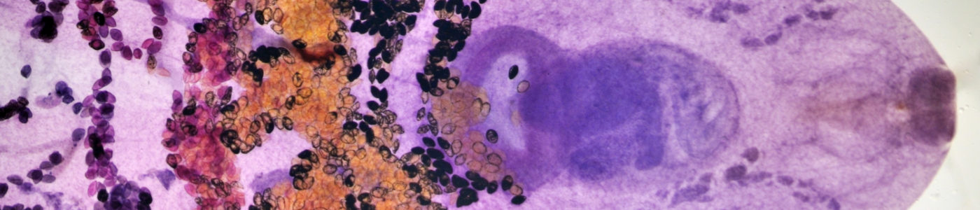 Fasciola hepatica - liver fluke diagnostics Fasciola hepatica - liver fluke diagnostics