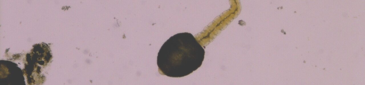 Rumen Fluke cercariae (3) (002) rumen|fluke