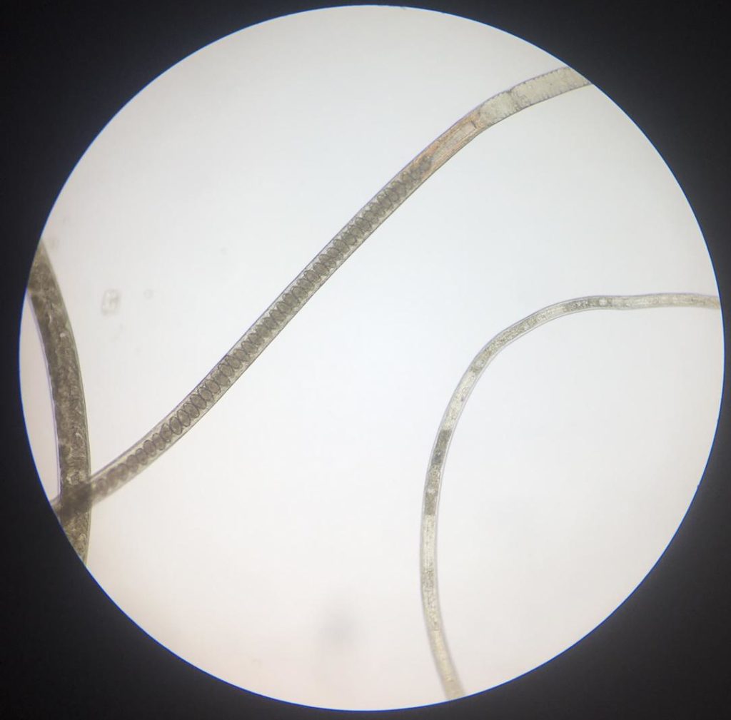 capillaria|obsignata|worm|parasite|ridgeway|research