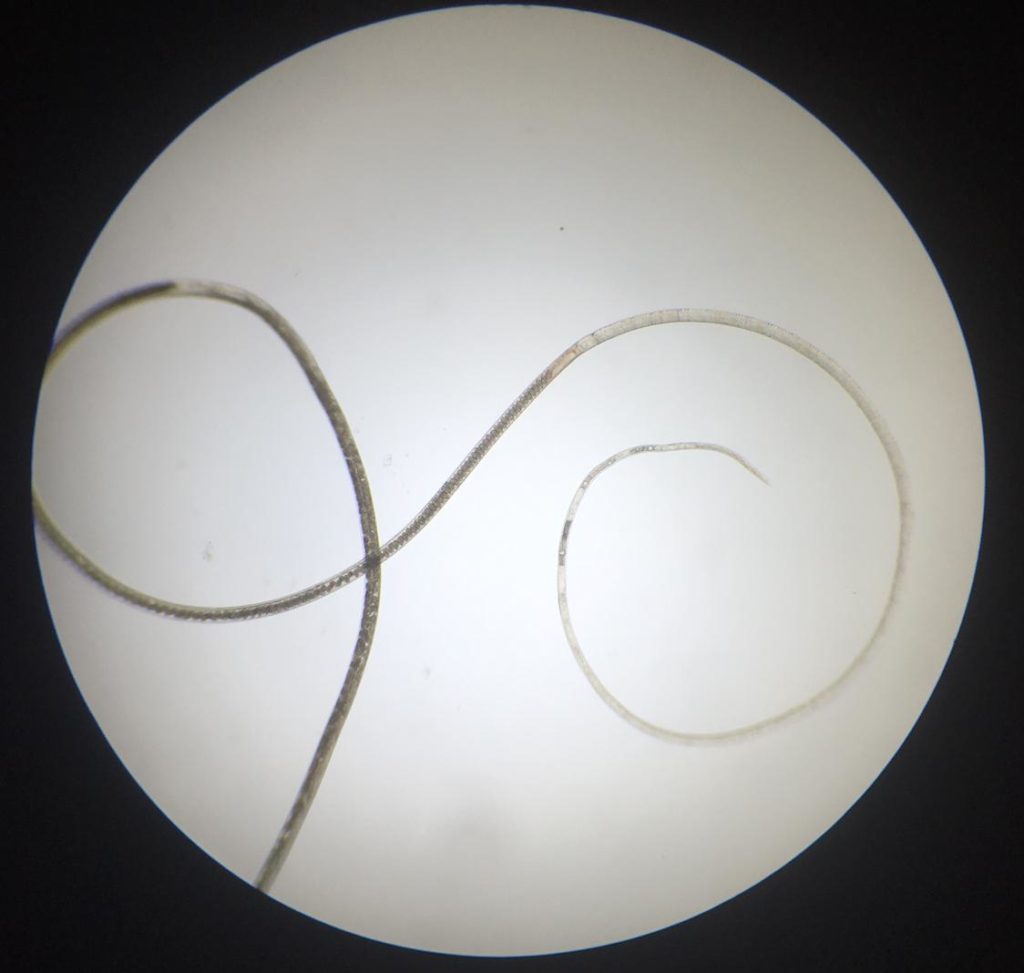 capillaria|obsignata|worm|parasite|ridgeway|research